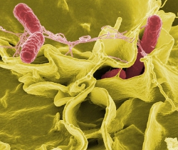 У Чернігові зареєстровано 66 випадків захворювань на гострі кишкові інфекції