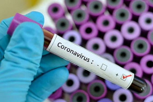 На Чернігівщині лабораторно підтверджений перший випадок коронавіруса COVID-2019