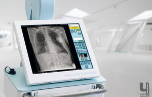 24 рентген-апарати для лікарень отримає Чернігівщина